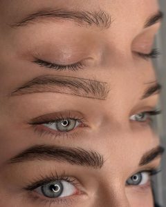 مدل میکروبلیدینگ