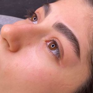 درد میکروبلیدینگ