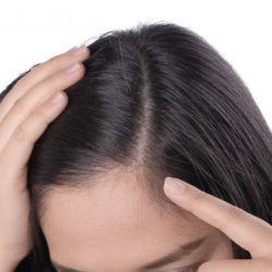 دوره اموزشی اسکالب